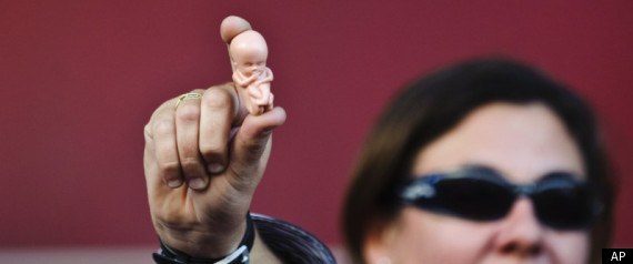 Personhood Amendment. Foto de AP Personhood Amendment. Foto de AP